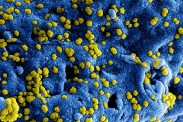 coronavirus